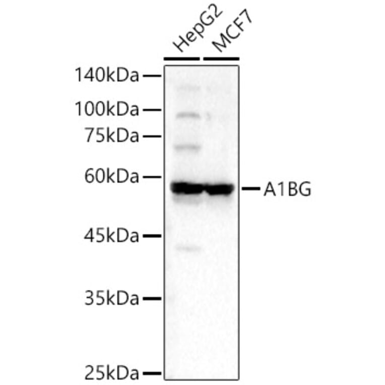Western Blot - Anti-alpha 1B Glycoprotein Antibody (A81062) - Antibodies.com