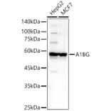 Western Blot - Anti-alpha 1B Glycoprotein Antibody (A81062) - Antibodies.com