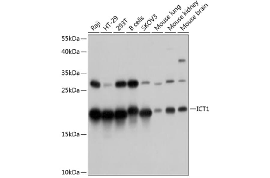 Western Blot - Anti-DS-1 Antibody (A81065) - Antibodies.com