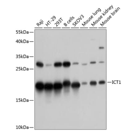 Western Blot - Anti-DS-1 Antibody (A81065) - Antibodies.com