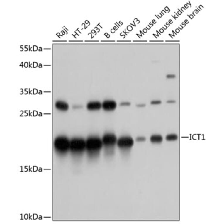 Western Blot - Anti-DS-1 Antibody (A81065) - Antibodies.com