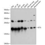 Western Blot - Anti-DS-1 Antibody (A81065) - Antibodies.com