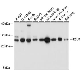 Western Blot - Anti-RSU1 Antibody (A81066) - Antibodies.com