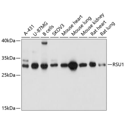 Western Blot - Anti-RSU1 Antibody (A81066) - Antibodies.com