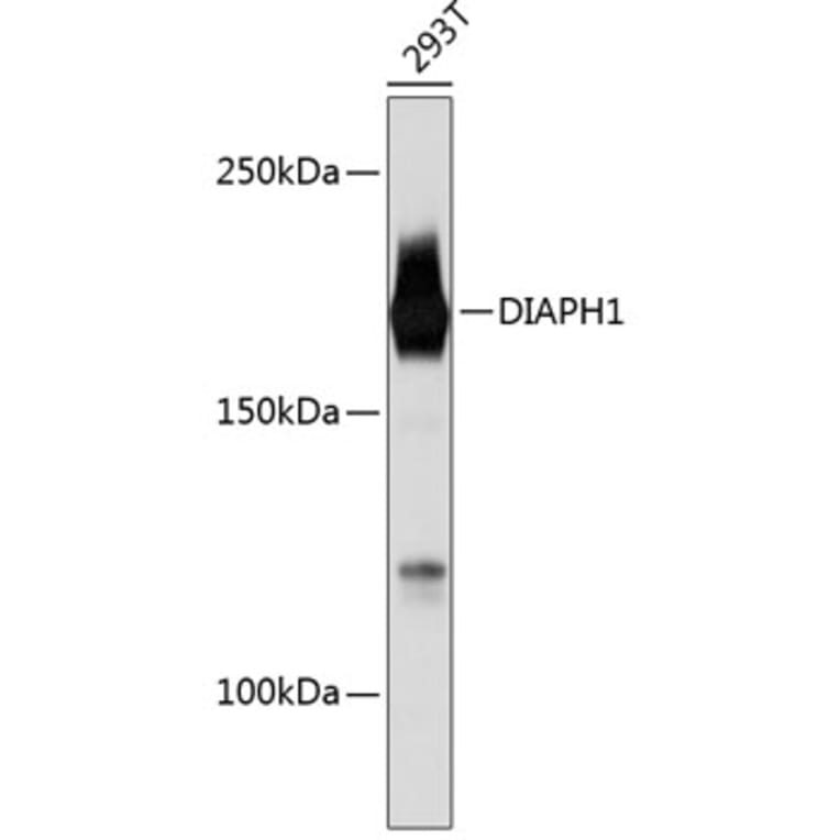 Western Blot - Anti-DIAPH1 Antibody [ARC0639] (A81067) - Antibodies.com