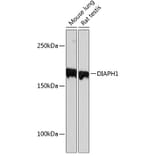 Western Blot - Anti-DIAPH1 Antibody [ARC0639] (A81067) - Antibodies.com