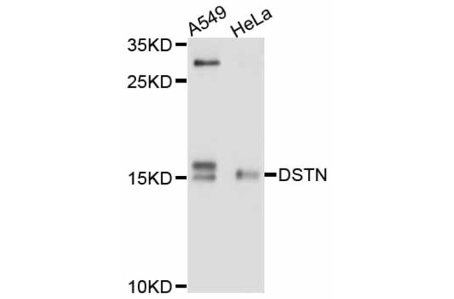 Western Blot - Anti-DSTN Antibody (A11603) - Antibodies.com