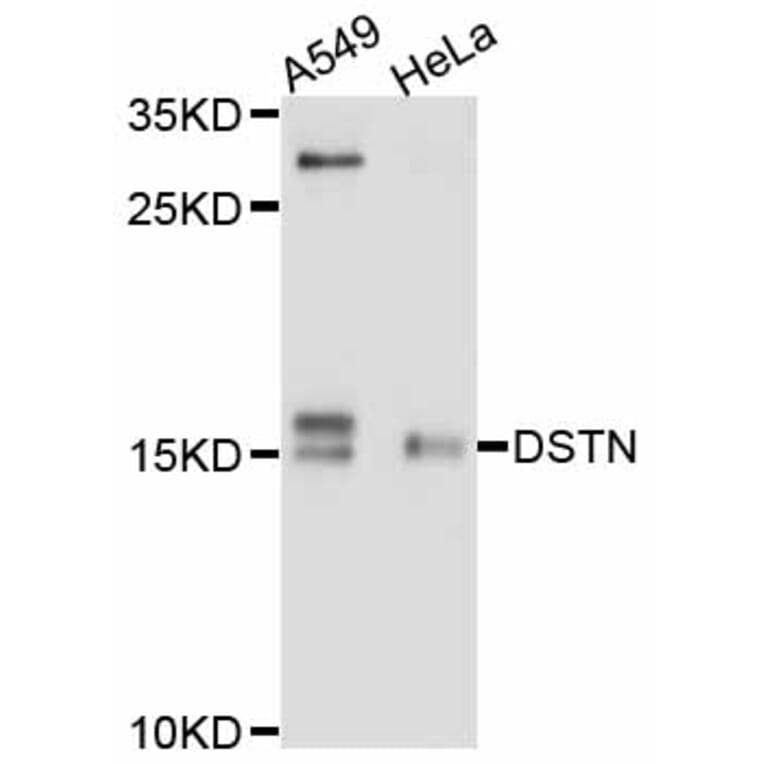 Western Blot - Anti-DSTN Antibody (A11603) - Antibodies.com