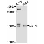 Western Blot - Anti-DSTN Antibody (A11603) - Antibodies.com