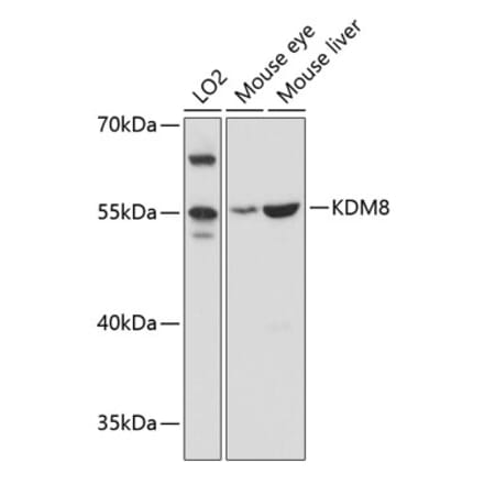 Western Blot - Anti-JMJD5 Antibody (A81069) - Antibodies.com