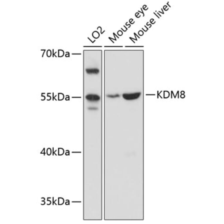 Western Blot - Anti-JMJD5 Antibody (A81069) - Antibodies.com