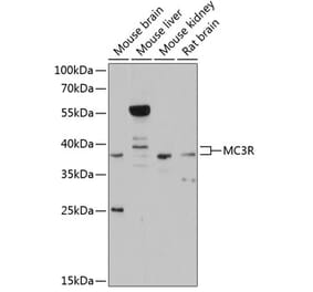 Western Blot - Anti-MC3-R Antibody (A81070) - Antibodies.com