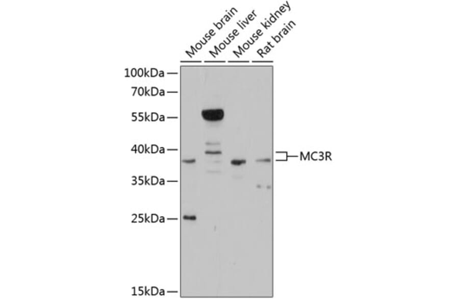 Western Blot - Anti-MC3-R Antibody (A81070) - Antibodies.com