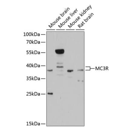 Western Blot - Anti-MC3-R Antibody (A81070) - Antibodies.com