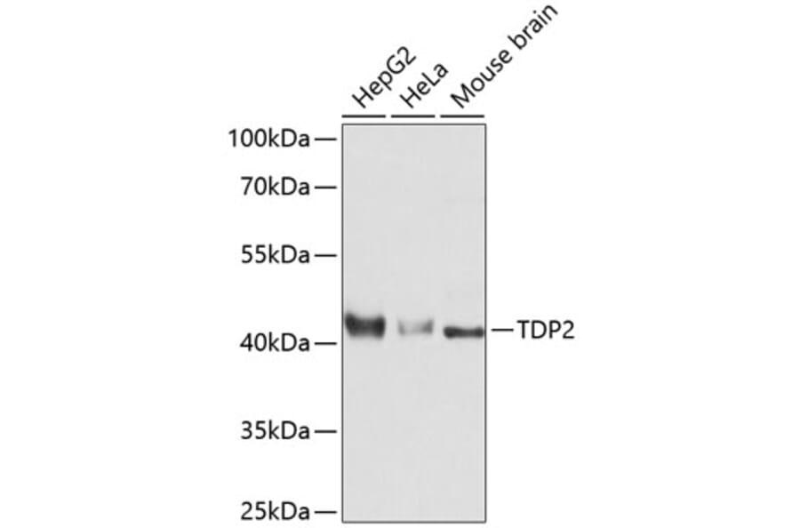 Western Blot - Anti-TDP2 Antibody (A11617) - Antibodies.com