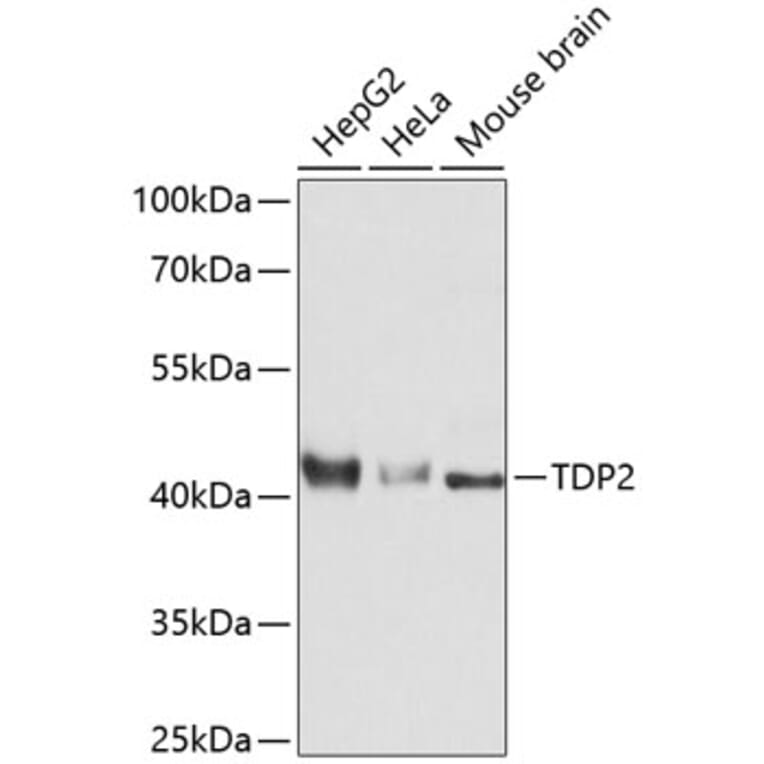 Western Blot - Anti-TDP2 Antibody (A11617) - Antibodies.com