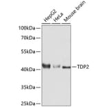 Western Blot - Anti-TDP2 Antibody (A11617) - Antibodies.com