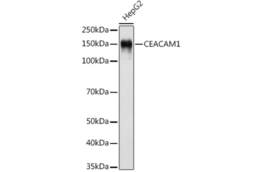 Western Blot - Anti-CEACAM1 Antibody [ARC0649] (A81072) - Antibodies.com