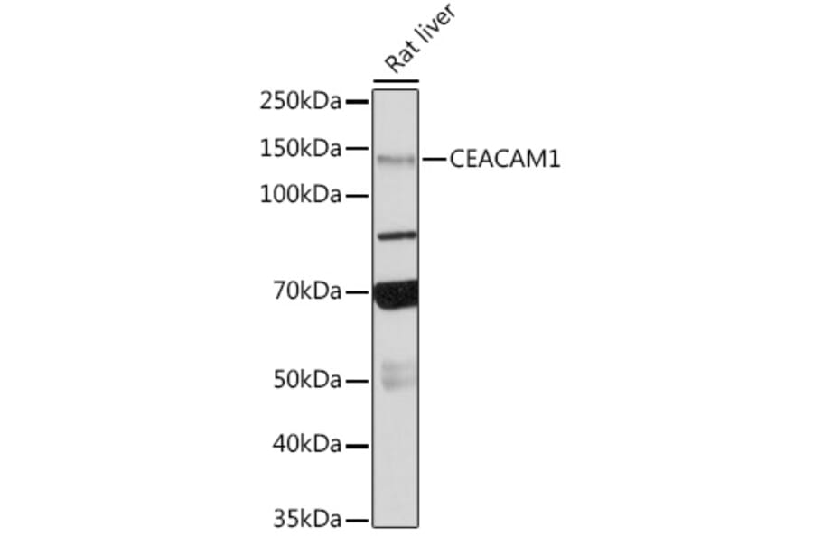 Western Blot - Anti-CEACAM1 Antibody [ARC0649] (A81072) - Antibodies.com