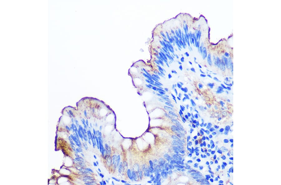 Immunohistochemistry - Anti-CEACAM1 Antibody [ARC0649] (A81072) - Antibodies.com