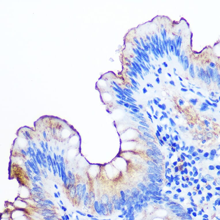 Immunohistochemistry - Anti-CEACAM1 Antibody [ARC0649] (A81072) - Antibodies.com