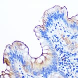 Immunohistochemistry - Anti-CEACAM1 Antibody [ARC0649] (A81072) - Antibodies.com