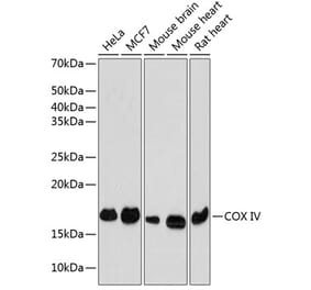 Western Blot - Anti-COX IV Antibody [ARC2518] (A81073) - Antibodies.com