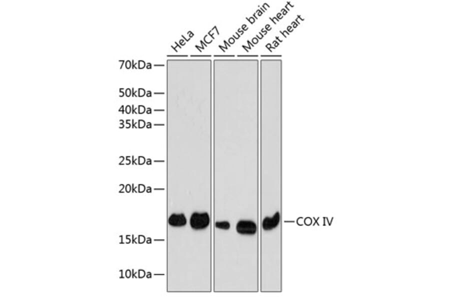 Western Blot - Anti-COX IV Antibody [ARC2518] (A81073) - Antibodies.com