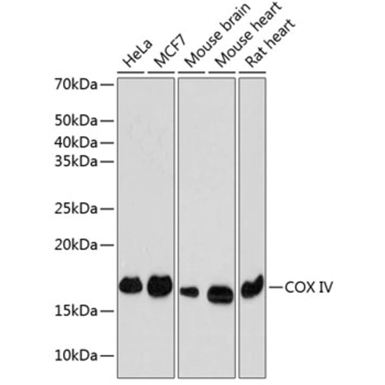 Western Blot - Anti-COX IV Antibody [ARC2518] (A81073) - Antibodies.com