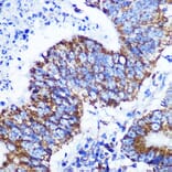 Immunohistochemistry - Anti-COX IV Antibody [ARC2518] (A81073) - Antibodies.com