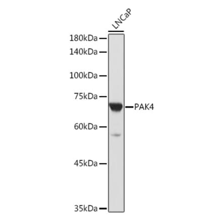 Western Blot - Anti-PAK4 Antibody (A81076) - Antibodies.com