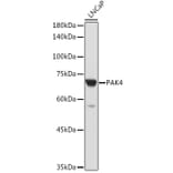 Western Blot - Anti-PAK4 Antibody (A81076) - Antibodies.com