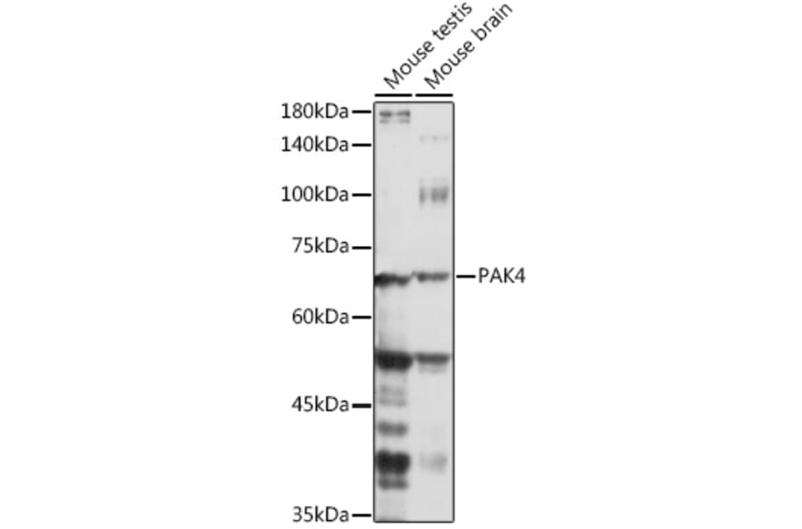 Western Blot - Anti-PAK4 Antibody (A81076) - Antibodies.com