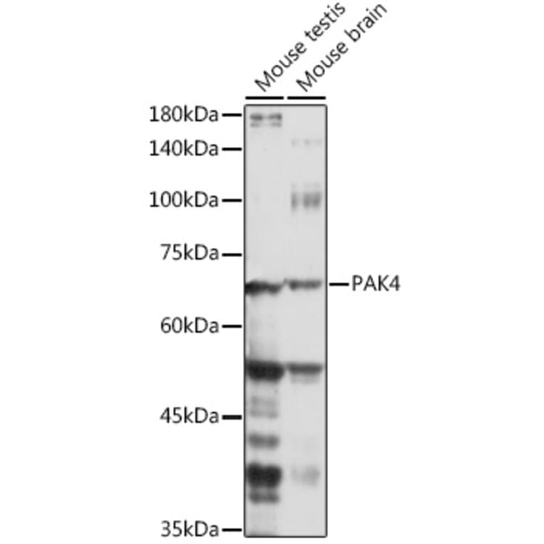 Western Blot - Anti-PAK4 Antibody (A81076) - Antibodies.com