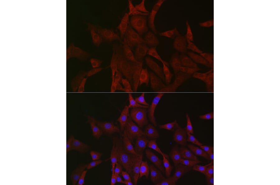 Immunofluorescence - Anti-PAK4 Antibody (A81076) - Antibodies.com