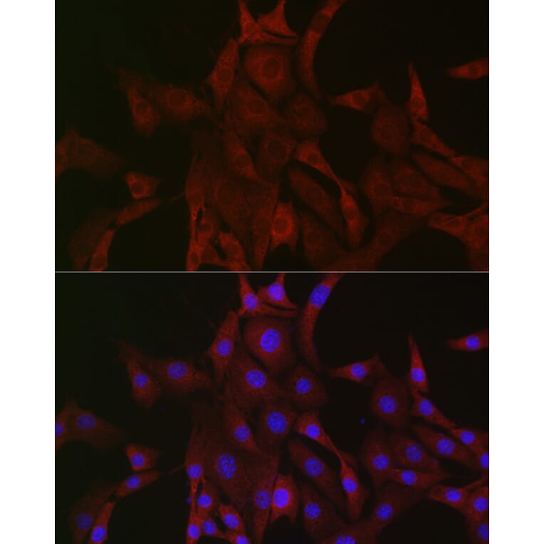 Immunofluorescence - Anti-PAK4 Antibody (A81076) - Antibodies.com