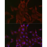 Immunofluorescence - Anti-PAK4 Antibody (A81076) - Antibodies.com