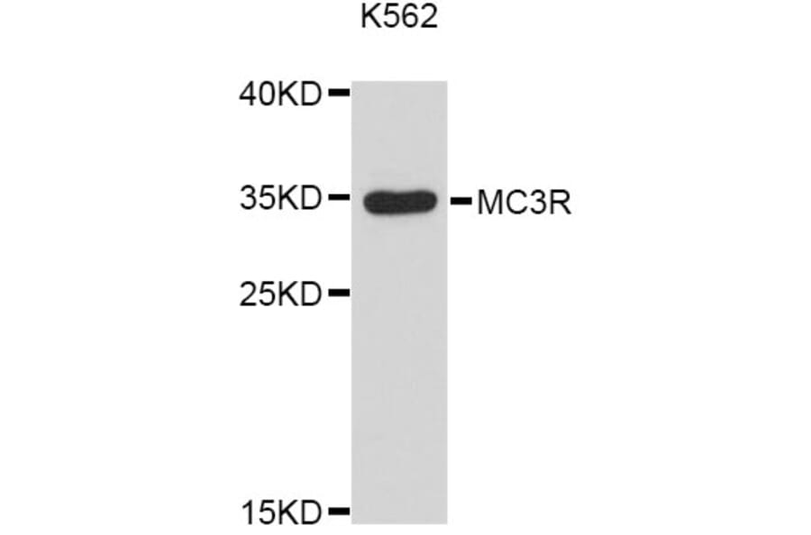 Western Blot - Anti-MC3R Antibody (A11654) - Antibodies.com