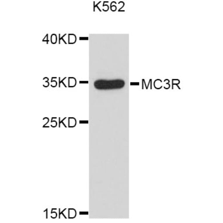 Western Blot - Anti-MC3R Antibody (A11654) - Antibodies.com