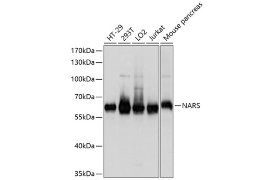 Western Blot - Anti-NARS Antibody (A81078) - Antibodies.com