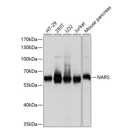 Western Blot - Anti-NARS Antibody (A81078) - Antibodies.com