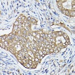 Immunohistochemistry - Anti-OLA1 Antibody (A81079) - Antibodies.com