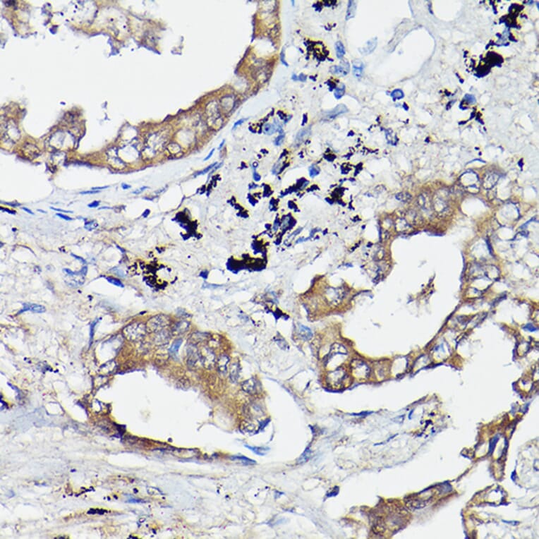 Immunohistochemistry - Anti-OLA1 Antibody (A81079) - Antibodies.com