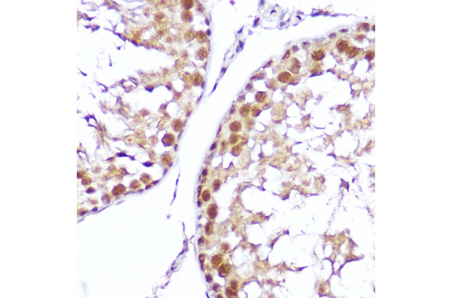 Immunohistochemistry - Anti-SMOX Antibody (A81080) - Antibodies.com