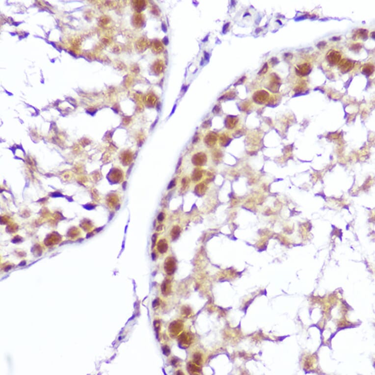 Immunohistochemistry - Anti-SMOX Antibody (A81080) - Antibodies.com