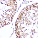 Immunohistochemistry - Anti-SMOX Antibody (A81080) - Antibodies.com