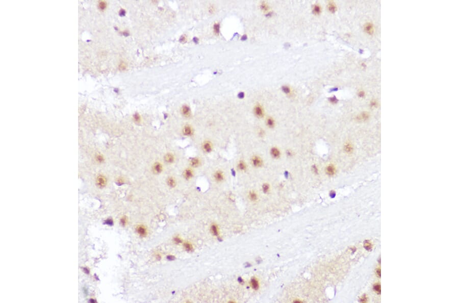 Immunohistochemistry - Anti-SMOX Antibody (A81080) - Antibodies.com