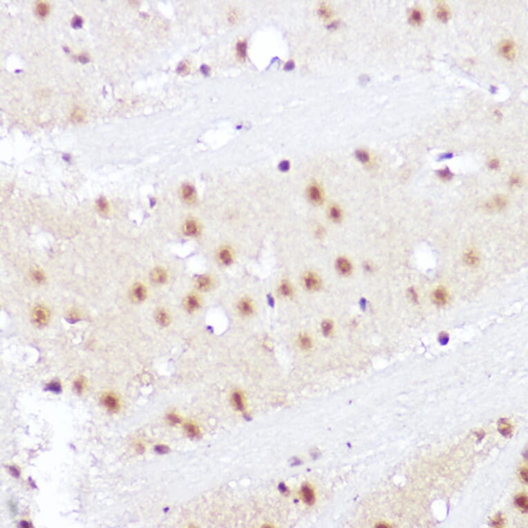 Immunohistochemistry - Anti-SMOX Antibody (A81080) - Antibodies.com