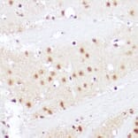 Immunohistochemistry - Anti-SMOX Antibody (A81080) - Antibodies.com