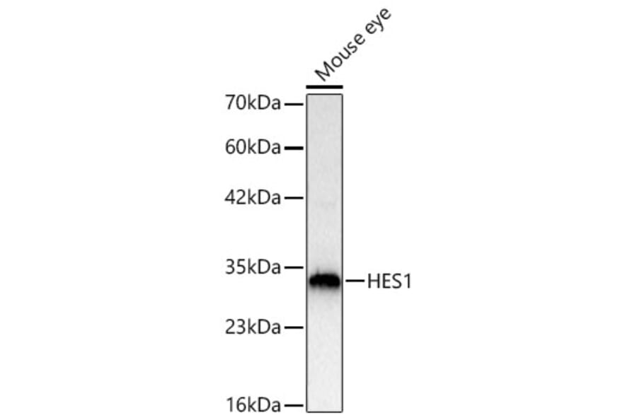 Western Blot - Anti-HES1 Antibody (A81081) - Antibodies.com